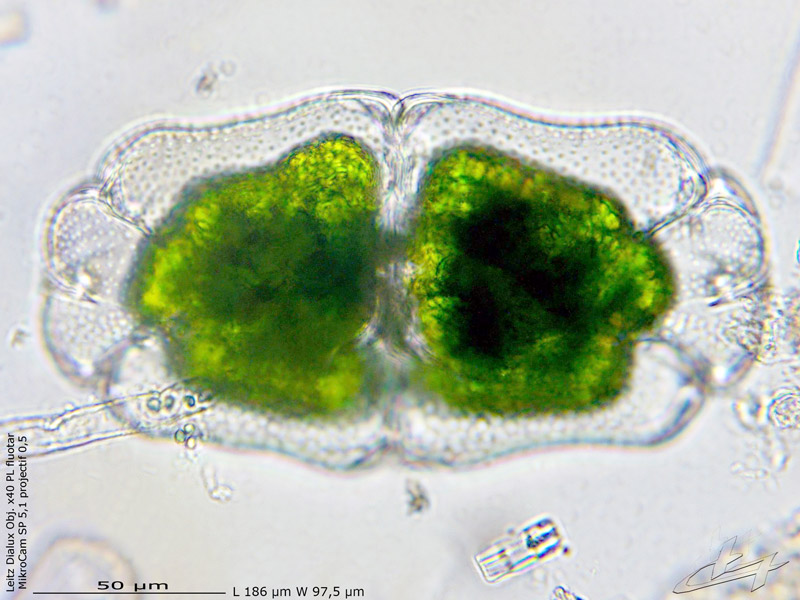 Euastrum crassum #65174