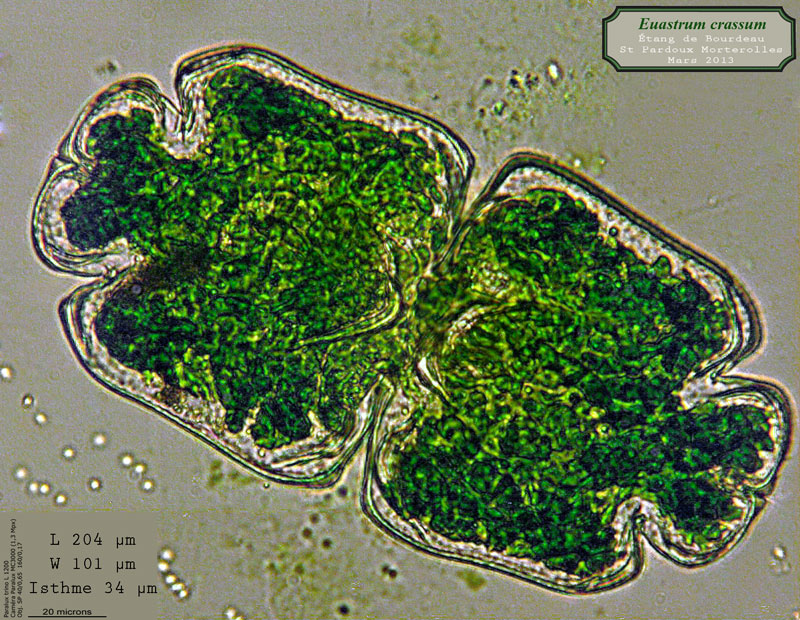 Euastrum crassum #62880