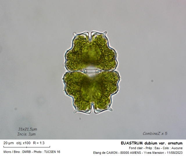 EUASTRUM dubium var. ornatum #75889