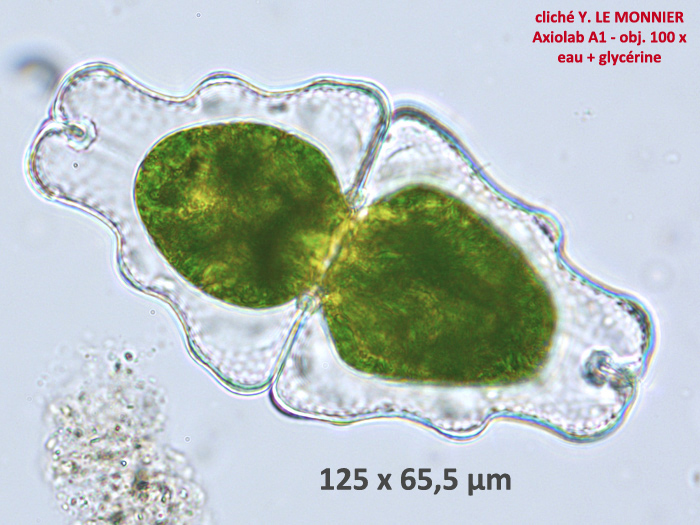 Euastrum humerosum Ralfs #81602