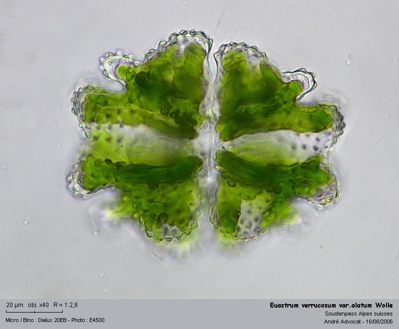 Euastrum verrucosum var. alatum Wolle #4847