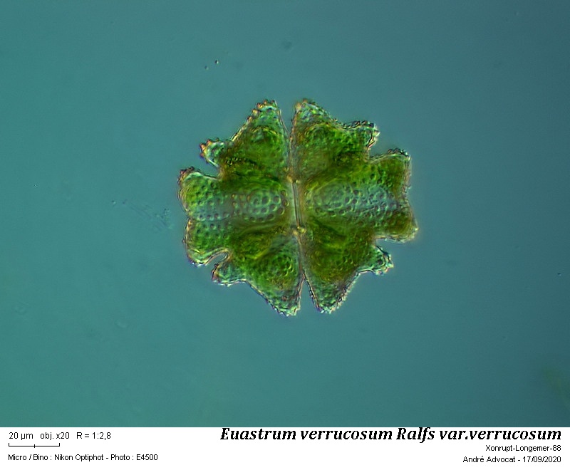 Euastrum verrucosum Ralfs var. verrucosum #64410