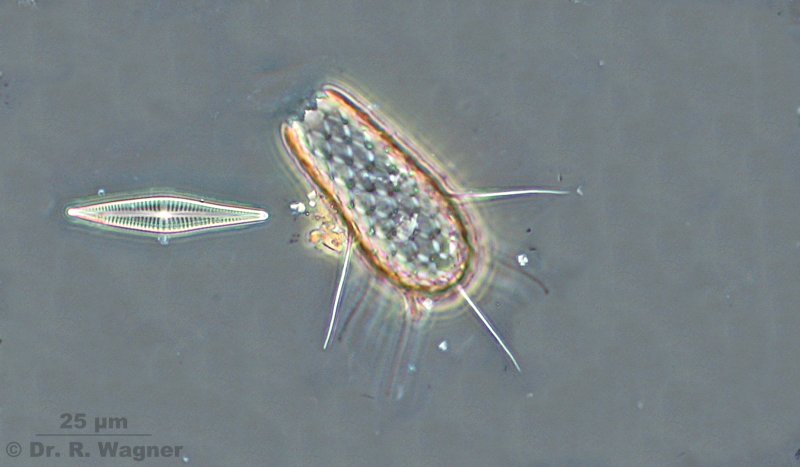 Euglypha acanthophora (Glühpräparat) #2246