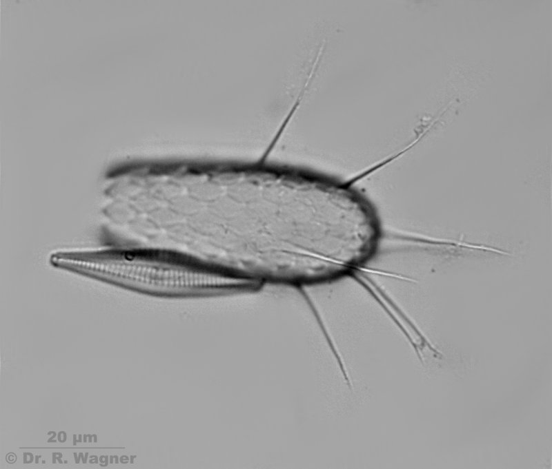 Euglypha acanthophora (Glühpräparat) #2247