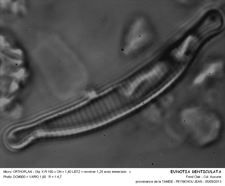 EUNOTIA DENTICULATA #33600