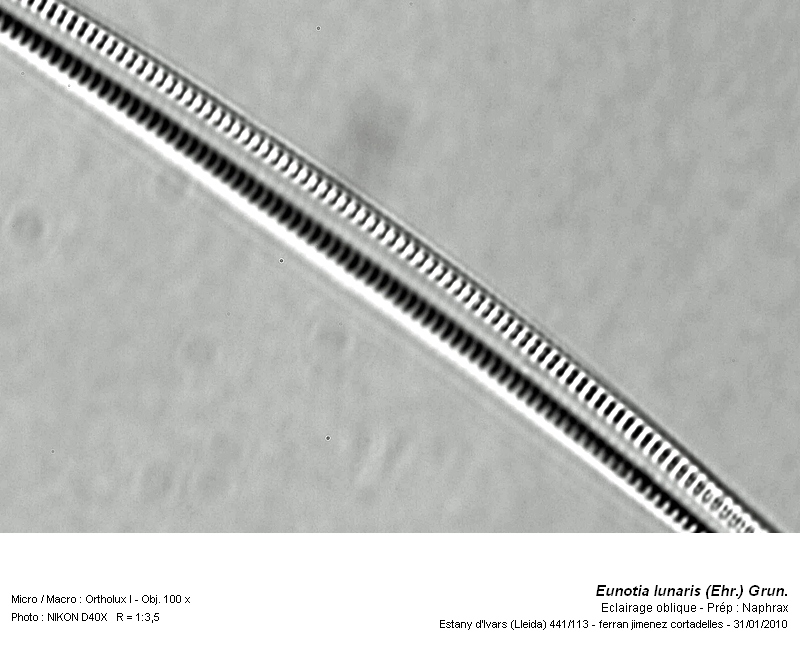Eunotia lunaris (Ehr.) Grun. #14861