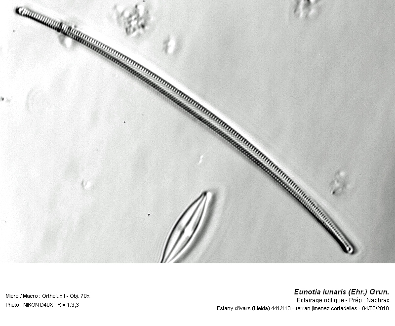 Eunotia lunaris (Ehr.) Grun. #14860