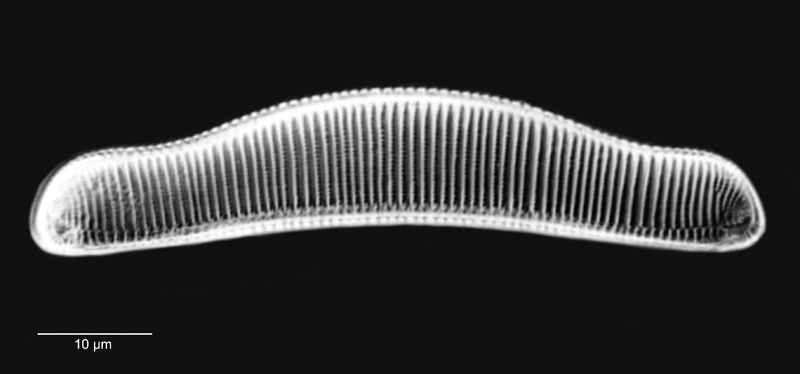 Eunotia metamonodon #69652