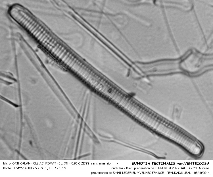 EUNOTIA PECTINALIS var. VENTRICOSA #39266