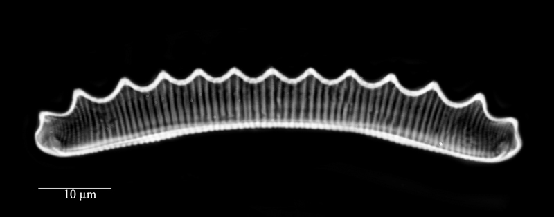 Eunotia serra #71647