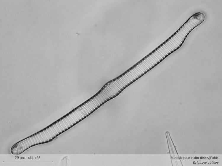 Eunotia sp. #41013