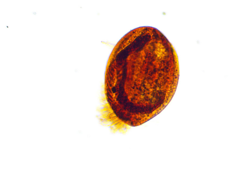 Euplotes sp #36247