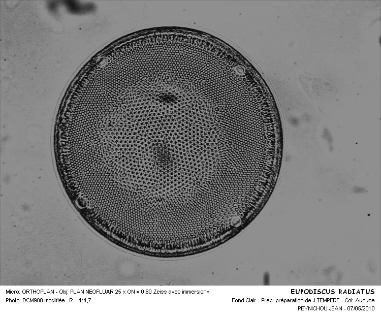 Eupodiscus radiatus Bailey #16011