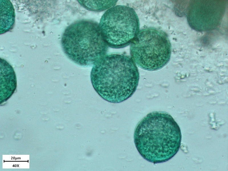Ficaria verna Huds., 1762 - Renoncule ficaire - Pollen #69855
