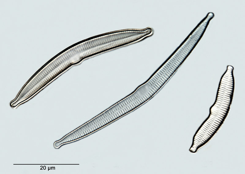 Fragilaria arcus #35293