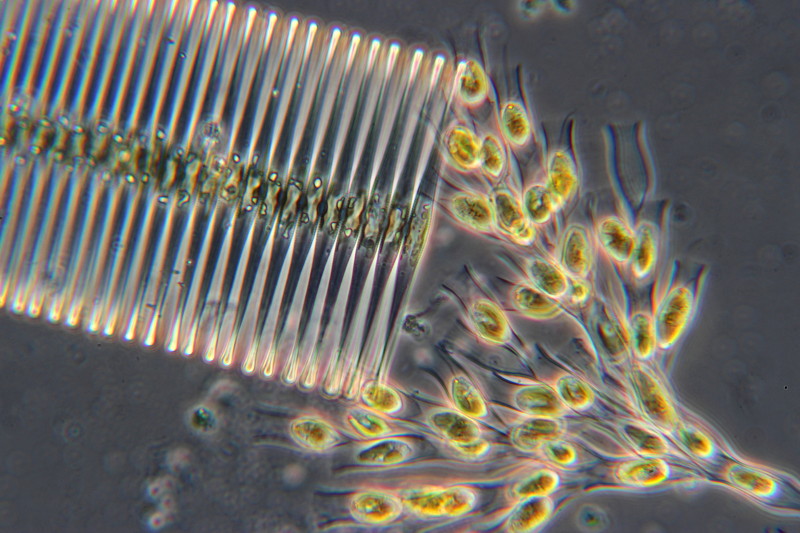 Fragilaria crotonensis et dinobryon sociale #34033