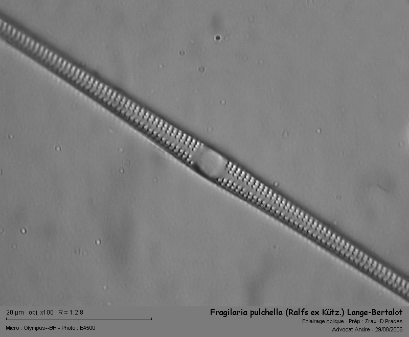 Fragilaria pulchella (Ralfs ex Kütz.) Lange-Bertalot #2955