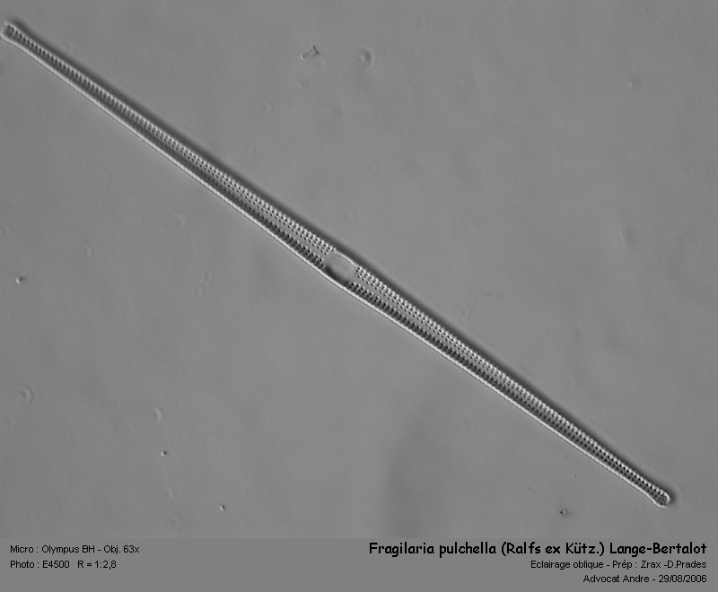 Fragilaria pulchella (Ralfs ex Kütz.) Lange-Bertalot #2954