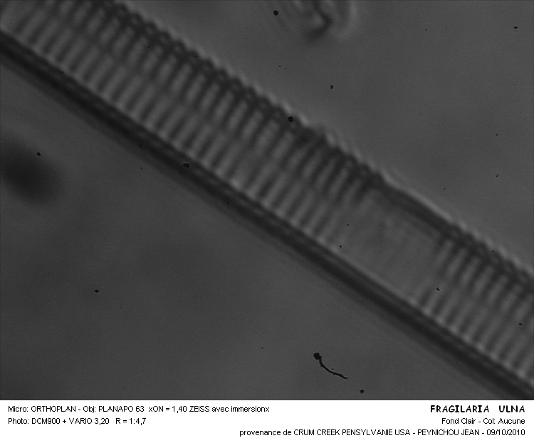 FRAGILARIA ULNA #32062