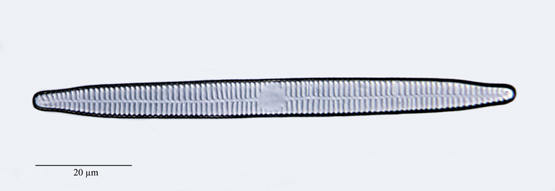 Fragilaria ulna #47776