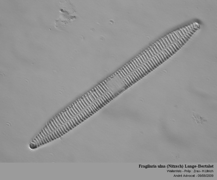 Fragilaria ulna (Nitzsch) Lange-Bertalot #79266