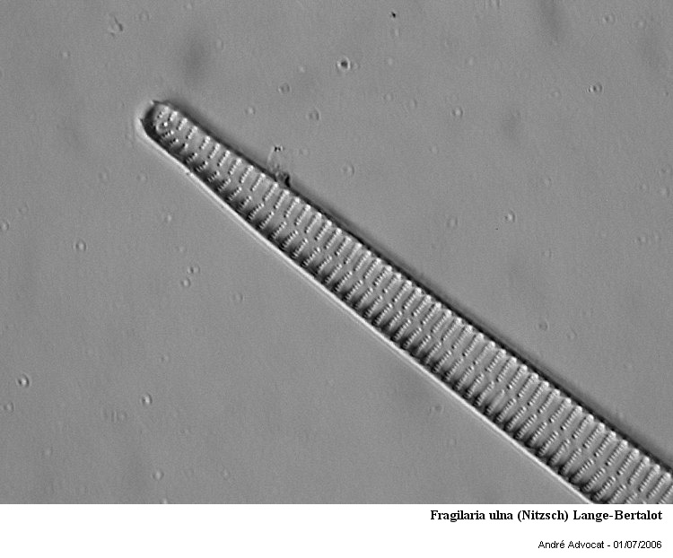 Fragilaria ulna (Nitzsch) Lange-Bertalot #79269