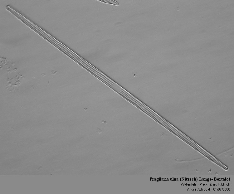 Fragilaria ulna (Nitzsch) Lange-Bertalot #79268