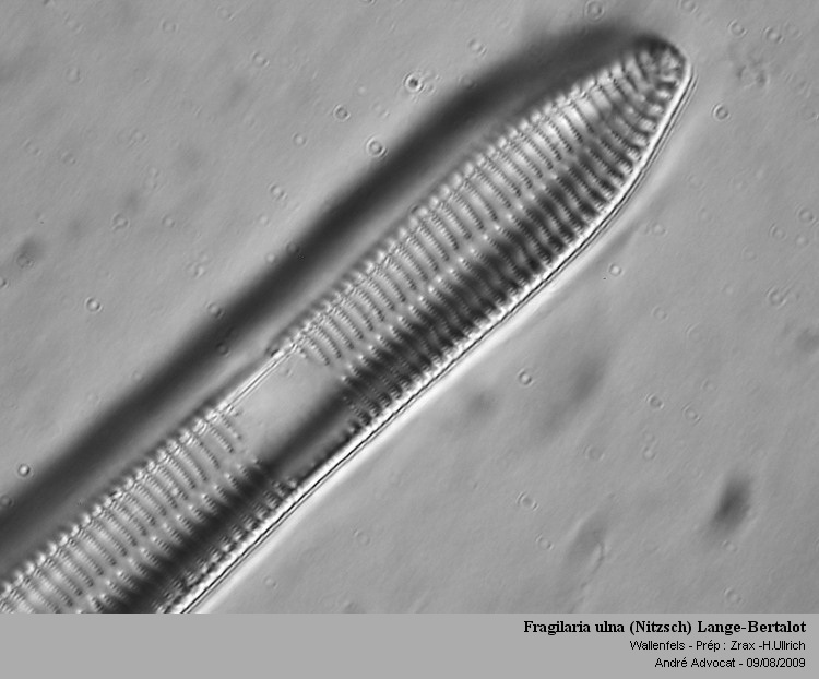 Fragilaria ulna (Nitzsch) Lange-Bertalot #79267