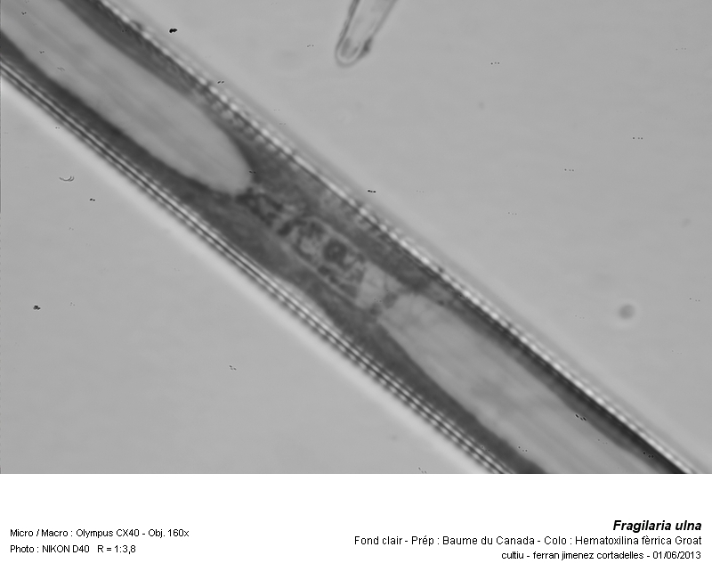 Fragilaria ulna (chromosomes) #31565
