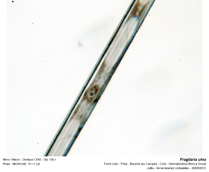Fragilaria ulna (chromosomes) #31564