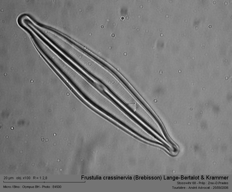 Frustulia crassinervia (Brebisson) Lange-Bertalot & Krammer #14080