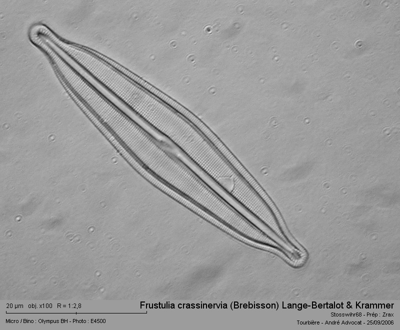 Frustulia crassinervia (Brebisson) Lange-Bertalot & Krammer #14082