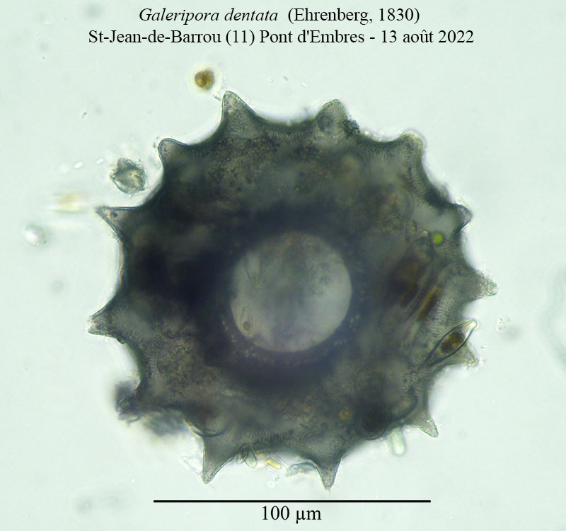 Galeripora dentata (= Arcella dentata} #71750