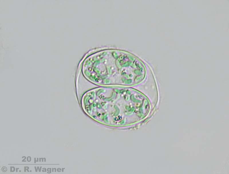 Glaucocystis #2675