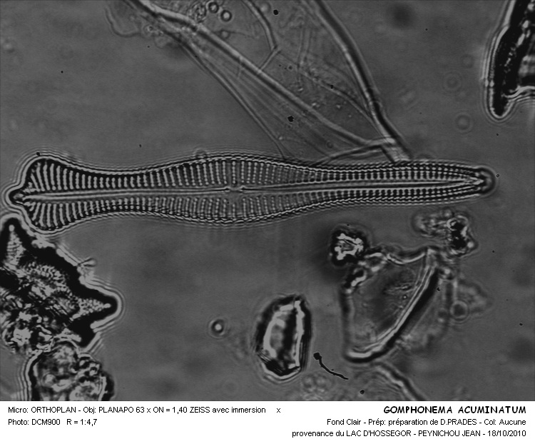 GOMPHONEMA ACUMINATUM #33602