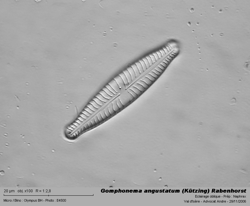 Gomphonema angustatum (Kützing) Rabenhorst #3437