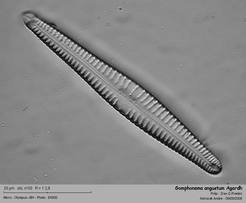 Gomphonema angustum Agardh 1831 #2467