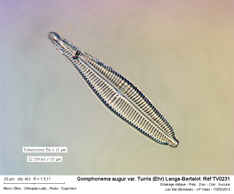 Gomphonema augur var. Turris #32395