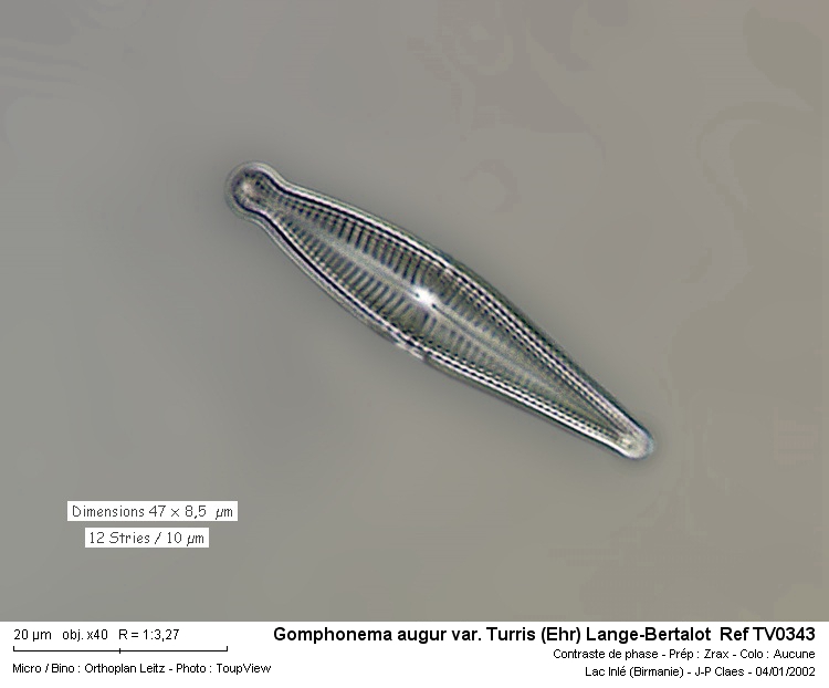 Gomphonema augur var. Turris #32398