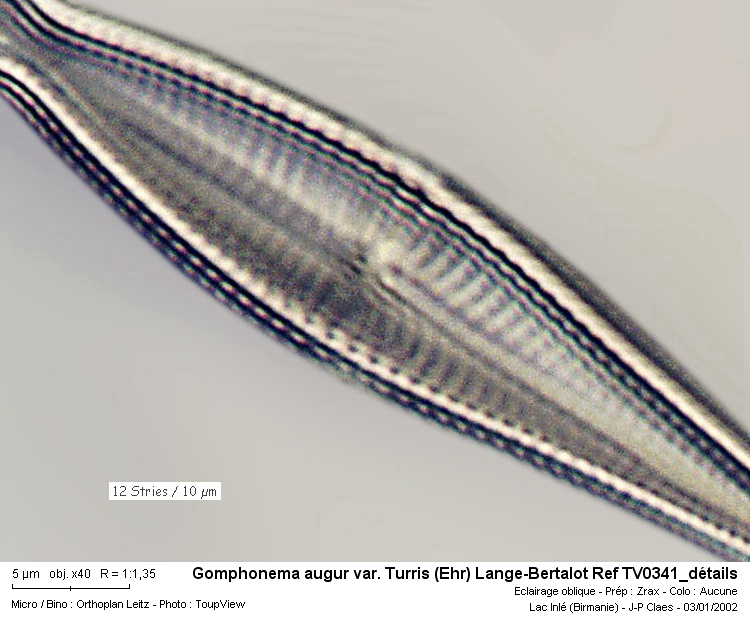 Gomphonema augur var. Turris #32400