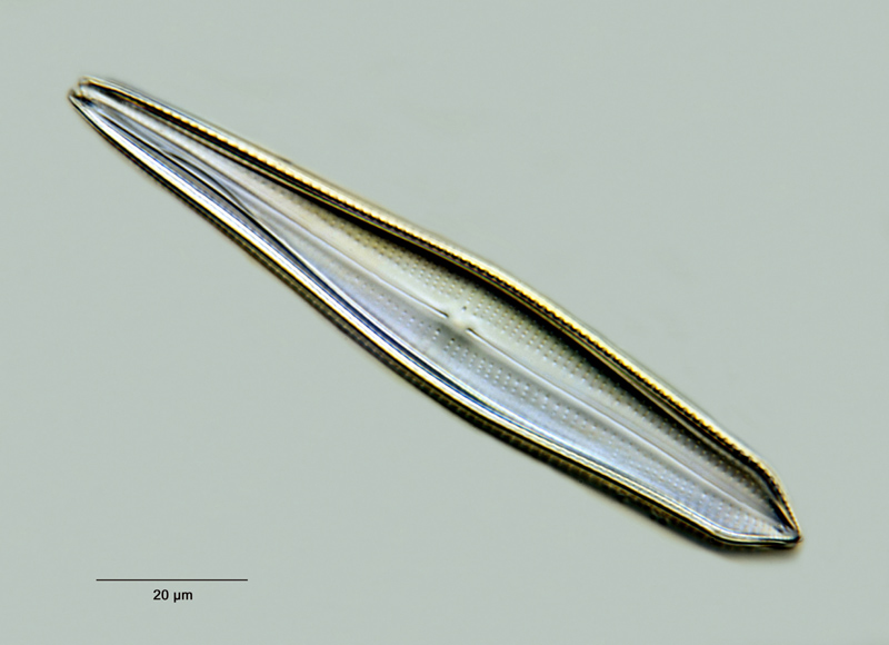 Gomphonema lanceolatum forma turris (Ehr.) Hustedt #26243