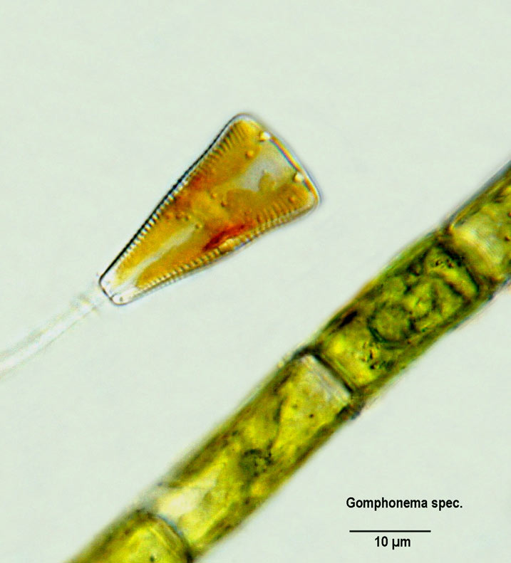Gomphonema spec. #6465