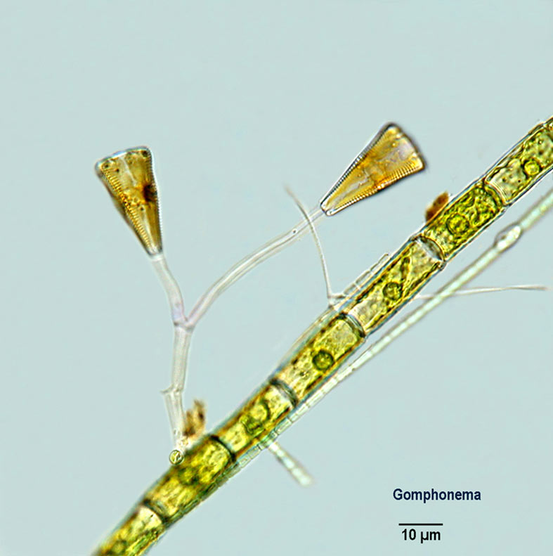 Gomphonema spec. #6464