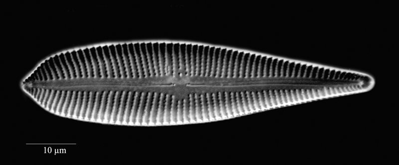 Gomphonema turris #72021
