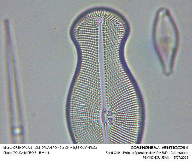 GOMPHONEMA VENTRICOSA #32043