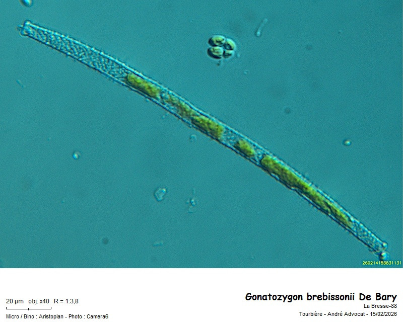 Gonatozygon brebissonii De Bary #85097
