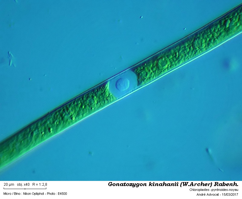 Gonatozygon kinahanii (W. Archer) Rabenh. #48957