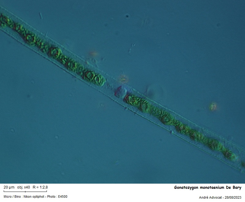 Gonatozygon monotaenium De Bary #76109