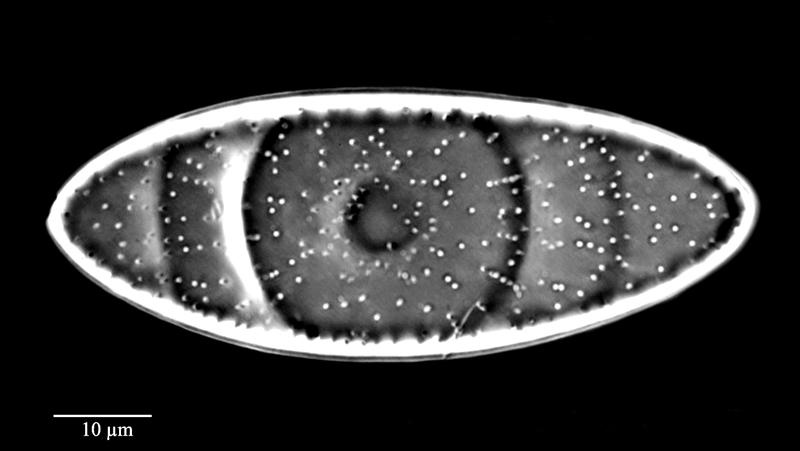 Goniothecium odontella #71545