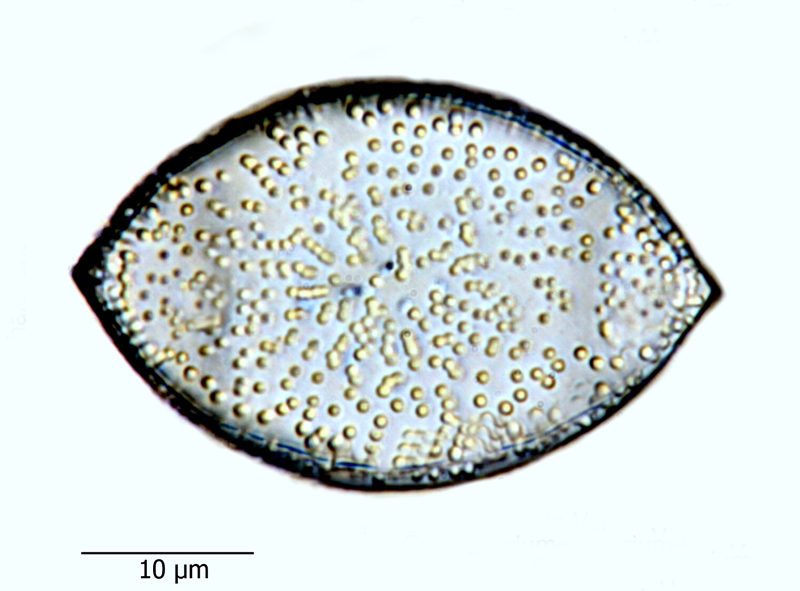 Goniothecium odontella var. danica #65747